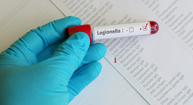 APHC issues Legionella warning following hospice death  image