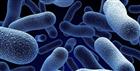 CIPHE warns of rise in Legionnaires’ cases image